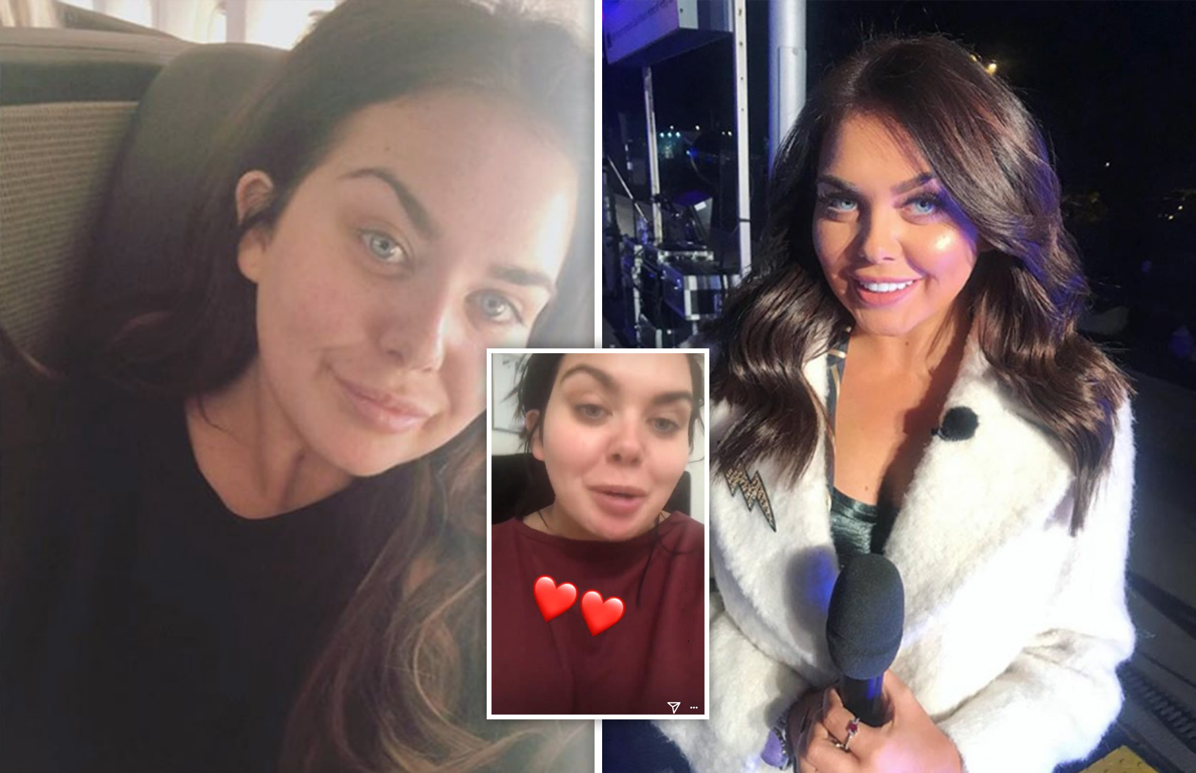 Scarlett Moffatt reveals she's NEVER had cosmetic surgery ...