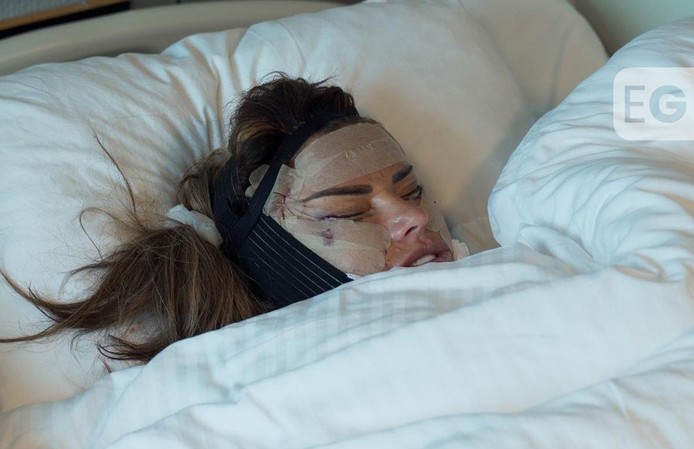 Katie Price to release harrowing video of new facelift